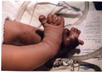 elijahtoes